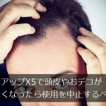 リアップX5で頭皮やおデコが赤くなったら使用をやめるべき？