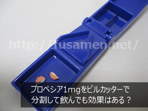 プロペシア1mg