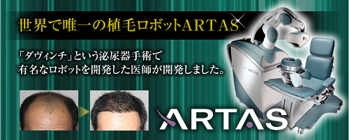 アルタス