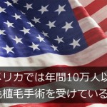 アメリカでは年間10万人以上が自毛植毛手術を受けている