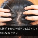 自毛植毛で髪の密度40％以上にすれば薄毛は改善できる