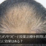 育毛メソセラピーとプロペシアを併用した方が薄毛に効果あり？