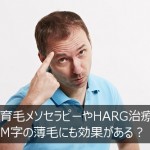 育毛メソセラピーやHARG治療は生え際の薄毛に効果がある？