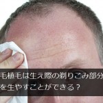 自毛植毛は生え際の剃りこみ部分にも髪を生やすことができる？