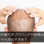 自毛植毛かプロペシアの投薬治療はどちらがおすすめ？