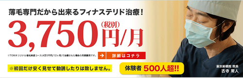 フィナステリド治療