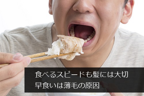 早食いと薄毛