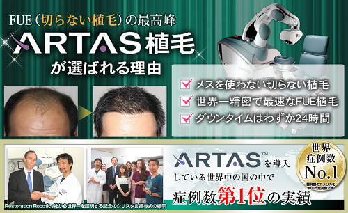 アルタス植毛