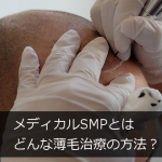 メディカルSMPとはどんな薄毛治療の方法？海外で話題のAGA対策