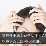 脂漏性皮膚炎を予防する方法＠放置すると薄毛の原因になる