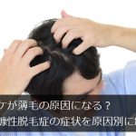 フケが薄毛の原因になる？粃糠性脱毛症の症状を原因別に解説