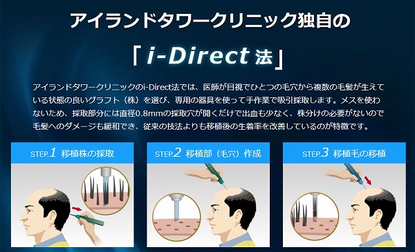 i-Direct