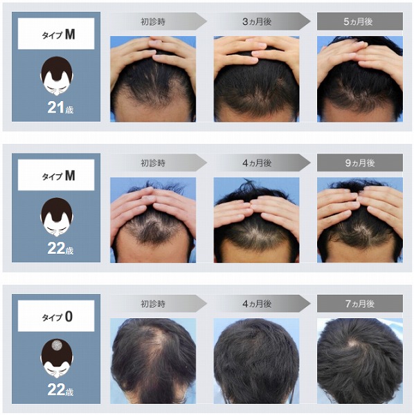 薄毛治療ヘアメディカル